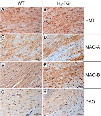 Histamine can be Formed and Degraded in the Human and Mouse Heart